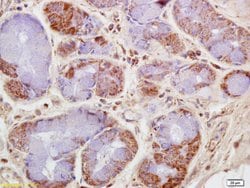 CKMT Rabbit anti-Human, Polyclonal, Bioss 100 &mu;L; Unconjugated:Antibodies,