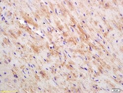 CKMT Rabbit anti-Human, Polyclonal, Bioss 100 &mu;L; Unconjugated:Antibodies,