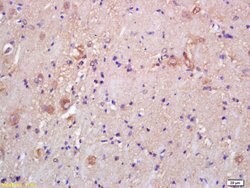 CKMT Rabbit anti-Human, Polyclonal, Bioss 100 &mu;L; Unconjugated:Antibodies,