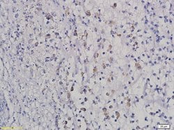 HOXB8 Rabbit anti-Human, Polyclonal, Bioss 100 &mu;L; Unconjugated:Antibodies,