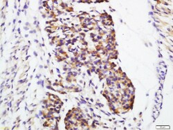 Galectin 1 Rabbit anti-Human, Polyclonal, Bioss 100 &mu;L; Unconjugated:Antibodies,