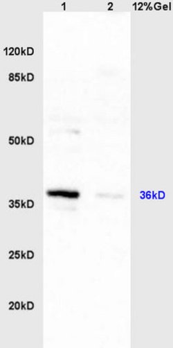 HSD17B1 Rabbit anti-Human, Polyclonal, Bioss 100 &mu;L; Unconjugated:Antibodies,