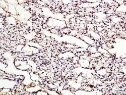 ApoER2 Rabbit anti-Human, Polyclonal, Bioss 100 &mu;L; Unconjugated:Antibodies,