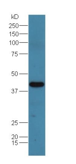 Adenosine deaminase Rabbit anti-Human, Polyclonal, Bioss 100 &mu;L; Unconjugated:Antibodies,