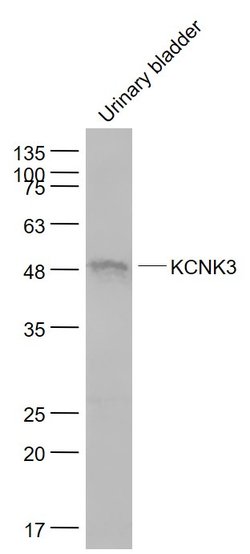 KCNK3 Rabbit anti-Human, Polyclonal, Bioss 100 &mu;L; Unconjugated:Antibodies,