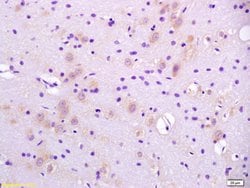 CaI-PLA2 Rabbit anti-Human, Polyclonal, Bioss 100 &mu;L; Unconjugated:Antibodies,