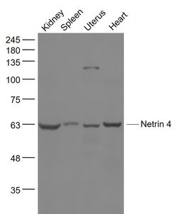 Netrin 4 Rabbit anti-Human, Polyclonal, Bioss 100 &mu;L; Unconjugated:Antibodies,