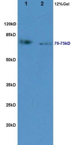 KIRREL2 Rabbit anti-Human, Polyclonal, Bioss 100 &mu;L; Unconjugated:Antibodies,