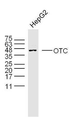OTC Rabbit anti-Human, Polyclonal, Bioss 100 &mu;L; Unconjugated:Antibodies,