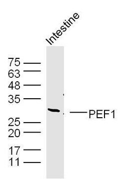 PEF1 Rabbit anti-Human, Polyclonal, Bioss 100 &mu;L; Unconjugated:Antibodies,