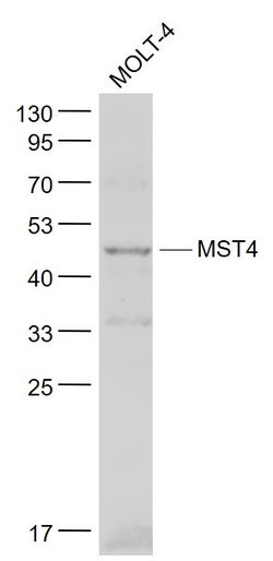 STK26 Rabbit anti-Human, Polyclonal, Bioss 100 &mu;L; Unconjugated:Antibodies,