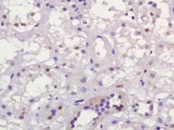 MUM1 Rabbit anti-Human, Polyclonal, Bioss 100 &mu;L; Unconjugated:Antibodies,