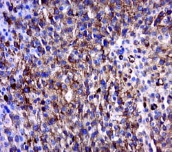 MAGEB6 Rabbit anti-Human, Polyclonal, Bioss 100 &mu;L; Unconjugated:Antibodies,