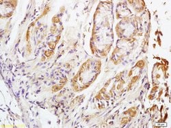 NALP4 Rabbit anti-Human, Polyclonal, Bioss 100 &mu;L; Unconjugated:Antibodies,
