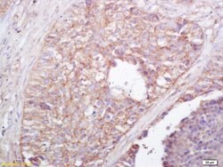 NALP4 Rabbit anti-Human, Polyclonal, Bioss 100 &mu;L; Unconjugated:Antibodies,