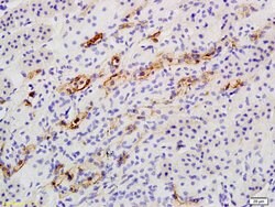 Catalase Rabbit anti-Human, Polyclonal, Bioss 100 &mu;L; Unconjugated:Antibodies,
