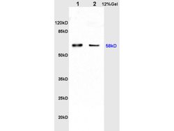 Catalase Rabbit anti-Human, Polyclonal, Bioss 100 &mu;L; Unconjugated:Antibodies,