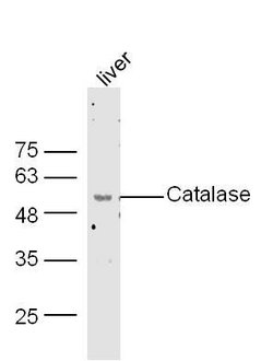 Catalase Rabbit anti-Human, Polyclonal, Bioss 100 &mu;L; Unconjugated:Antibodies,