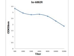 BRF2 Rabbit anti-Human, Polyclonal, Bioss 100 &mu;L; Unconjugated:Antibodies,