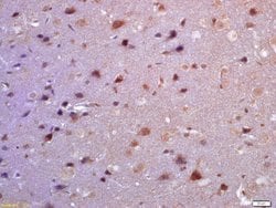 TSSC3 Rabbit anti-Human, Polyclonal, Bioss 100 &mu;L; Unconjugated:Antibodies,