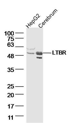 LTBR Rabbit anti-Human, Polyclonal, Bioss 100 &mu;L; Unconjugated:Antibodies,