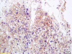 MICA+MICB Rabbit anti-Human, Polyclonal, Bioss 100 &mu;L; Unconjugated:Antibodies,