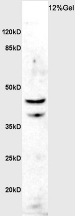 ASMT Rabbit anti-Human, Polyclonal, Bioss 100 &mu;L; Unconjugated:Antibodies,