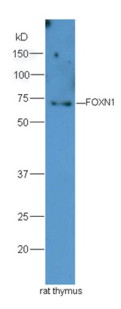 FOXN1 Rabbit anti-Human, Polyclonal, Bioss 100 &mu;L | Buy Online | Bioss | Fisher Scientific
