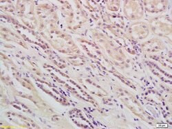 Phospholipase C beta 1 Rabbit anti-Human, Polyclonal, Bioss 100 &mu;L;