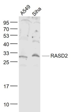 RASD2 Rabbit anti-Human, Polyclonal, Bioss 100 &mu;L; Unconjugated:Antibodies,