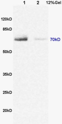 DENTT Rabbit anti-Human, Polyclonal, Bioss 100 &mu;L; Unconjugated:Antibodies,
