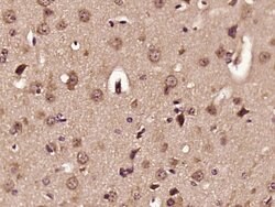 ELOVL2 Rabbit anti-Human, Polyclonal, Bioss 100 &mu;L; Unconjugated:Antibodies,