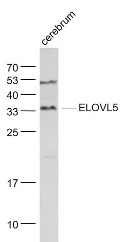 ELOVL5 Rabbit anti-Human, Polyclonal, Bioss 100 &mu;L; Unconjugated:Antibodies,