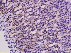PNPT1 Rabbit anti-Human, Polyclonal, Bioss 100 &mu;L; Unconjugated:Antibodies,