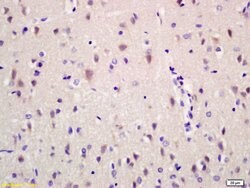 Ribonuclease Inhibitor Rabbit anti-Human, Polyclonal, Bioss 100 &mu;L;