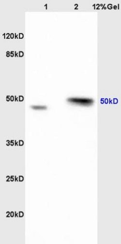 Ribonuclease Inhibitor Rabbit anti-Human, Polyclonal, Bioss 100 &mu;L;