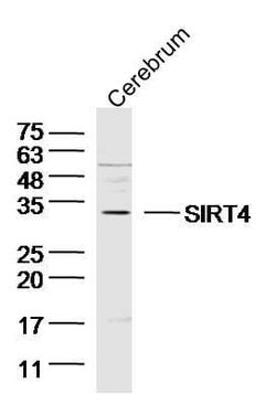 SIRT4 Rabbit anti-Human, Polyclonal, Bioss 100 &mu;L; Unconjugated:Antibodies,