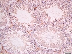 SOAT1 Rabbit anti-Human, Polyclonal, Bioss 100 &mu;L; Unconjugated:Antibodies,