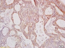 Galactosidase alpha Rabbit anti-Human, Polyclonal, Bioss 100 &mu;L; Unconjugated:Antibodies,