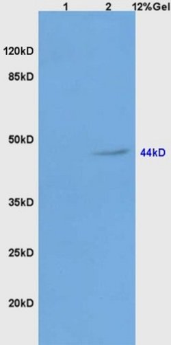 Galactosidase alpha Rabbit anti-Human, Polyclonal, Bioss 100 &mu;L; Unconjugated:Antibodies,