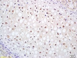 CDC14B Rabbit anti-Human, Polyclonal, Bioss 100 &mu;L; Unconjugated:Antibodies,