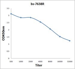 RHCG Rabbit anti-Human, Polyclonal, Bioss 100 &mu;L; Unconjugated:Antibodies,