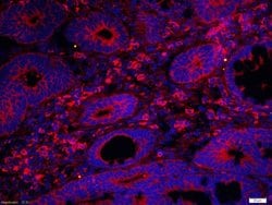 DNase 2 alpha Rabbit anti-Human, Polyclonal, Bioss 100 &mu;L; Unconjugated:Antibodies,