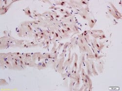 DNase gamma Rabbit anti-Human, Polyclonal, Bioss 100 &mu;L; Unconjugated:Antibodies,