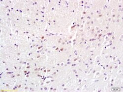 Adenovirus 5 E1A binding protein Rabbit anti-Human, Polyclonal, Bioss 100