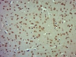 ZBTB2 Rabbit anti-Human, Polyclonal, Bioss 100 &mu;L; Unconjugated:Antibodies,