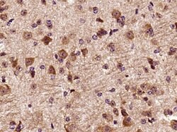 DCTN3 Rabbit anti-Human, Polyclonal, Bioss 100 &mu;L; Unconjugated:Antibodies,