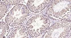 NEK7 Rabbit anti-Human, Polyclonal, Bioss 100 &mu;L; Unconjugated:Antibodies,