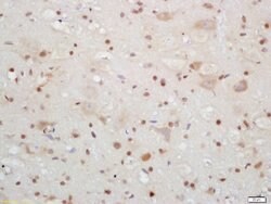 CIRBP Rabbit anti-Human, Polyclonal, Bioss 100 &mu;L; Unconjugated:Antibodies,