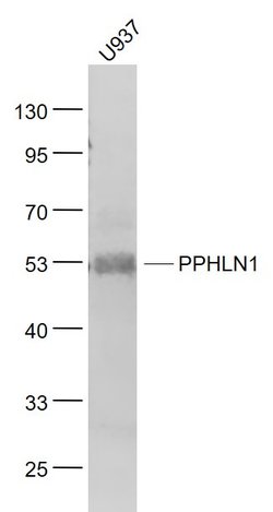 PPHLN1 Rabbit anti-Human, Polyclonal, Bioss 100 &mu;L; Unconjugated:Antibodies,